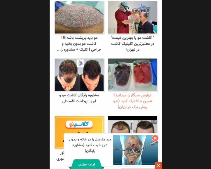 تبلیغات نیتیو یا همسان بی کیفیت در ایران - تبلیغات آنلاین بی هدف و بی کیفیت